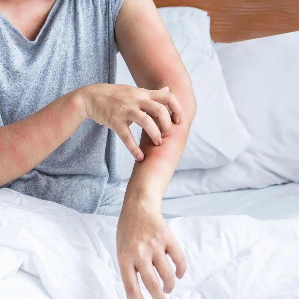 SIGNS OF BED BUG INFESTATIONS